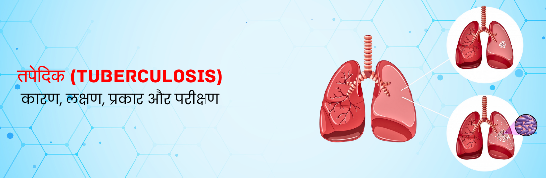 तपेदिक: कारण, लक्षण, प्रकार और परीक्षण